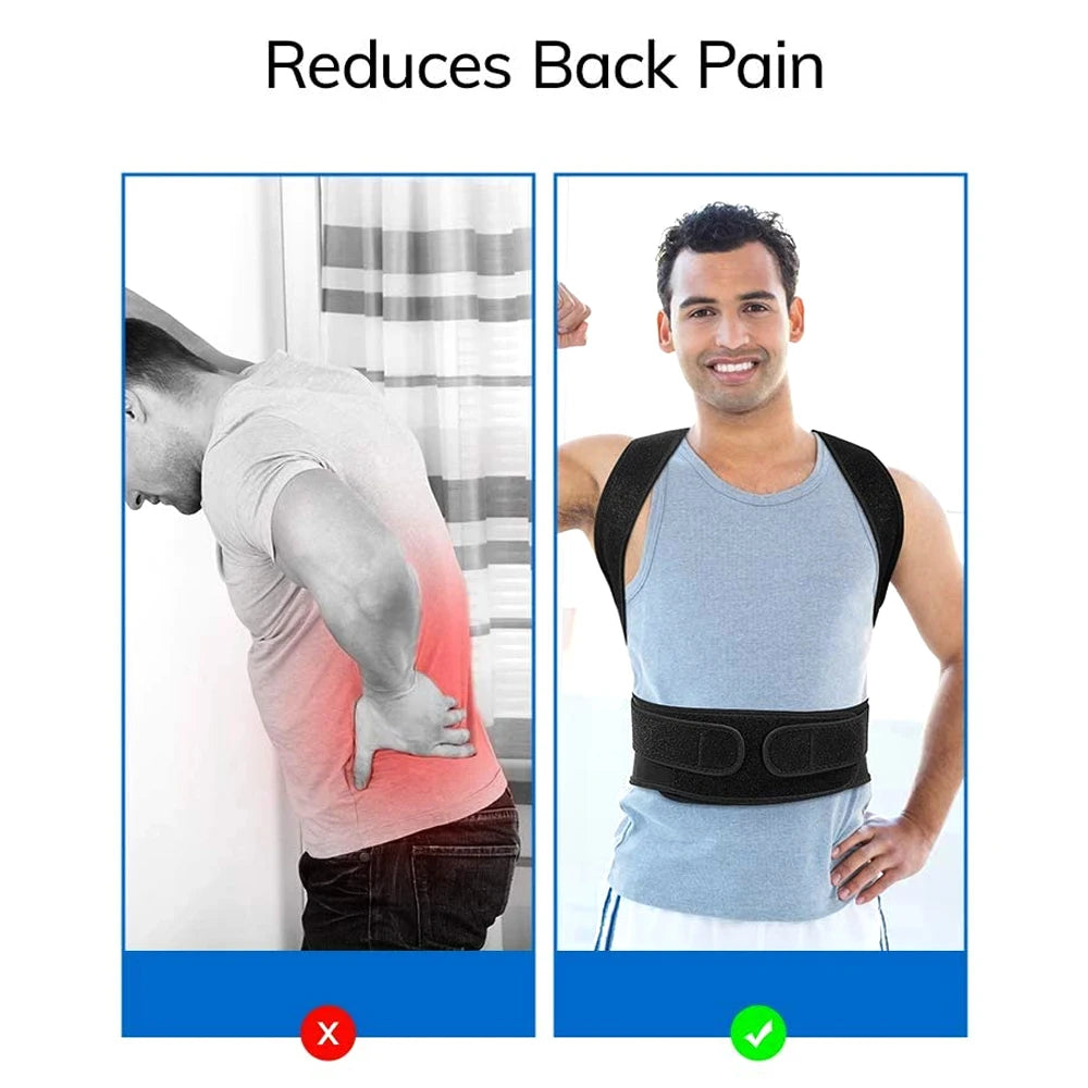 BOND™ Back Brace Posture Corrector