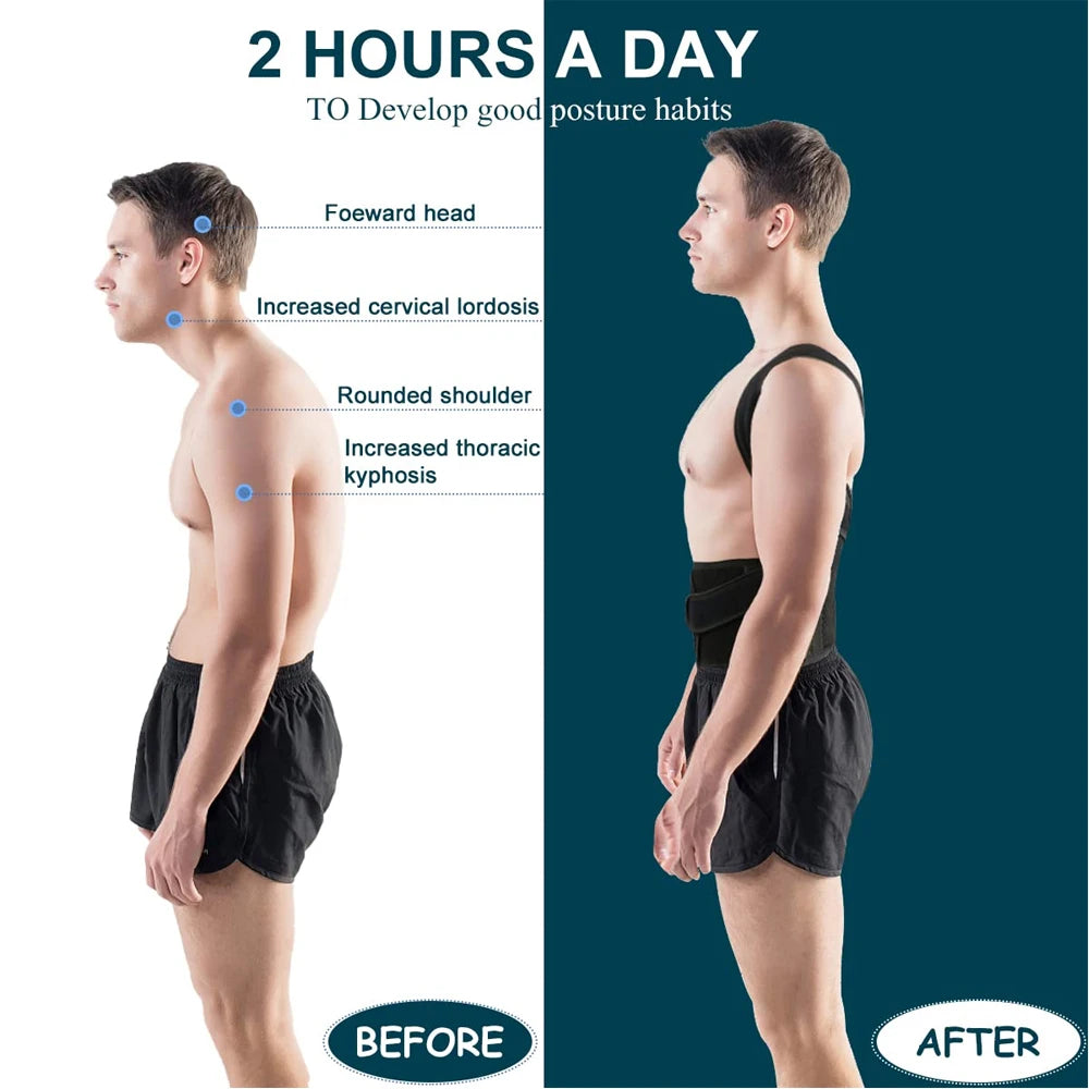 BOND™ Back Brace Posture Corrector