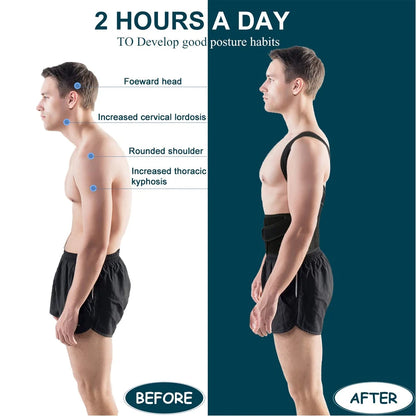 BOND™ Back Brace Posture Corrector